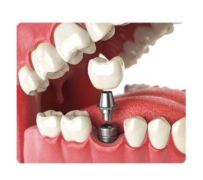 Dental Prosthetics Laboratory